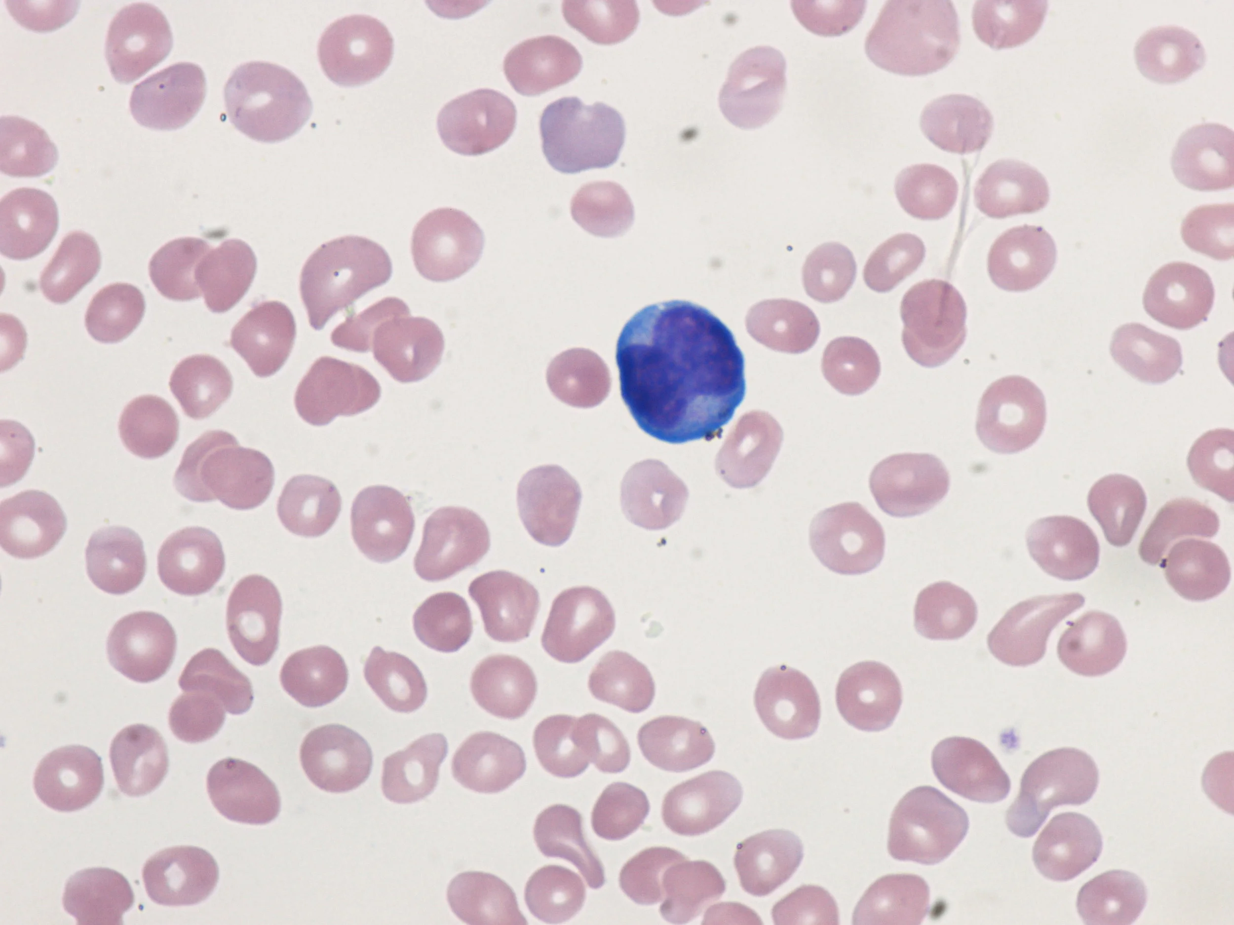 Blasts Corpath - 
