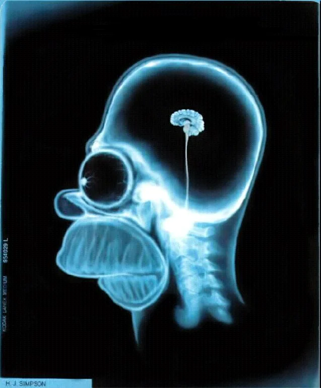 Homer Simpson's flawed and tiny brain. 