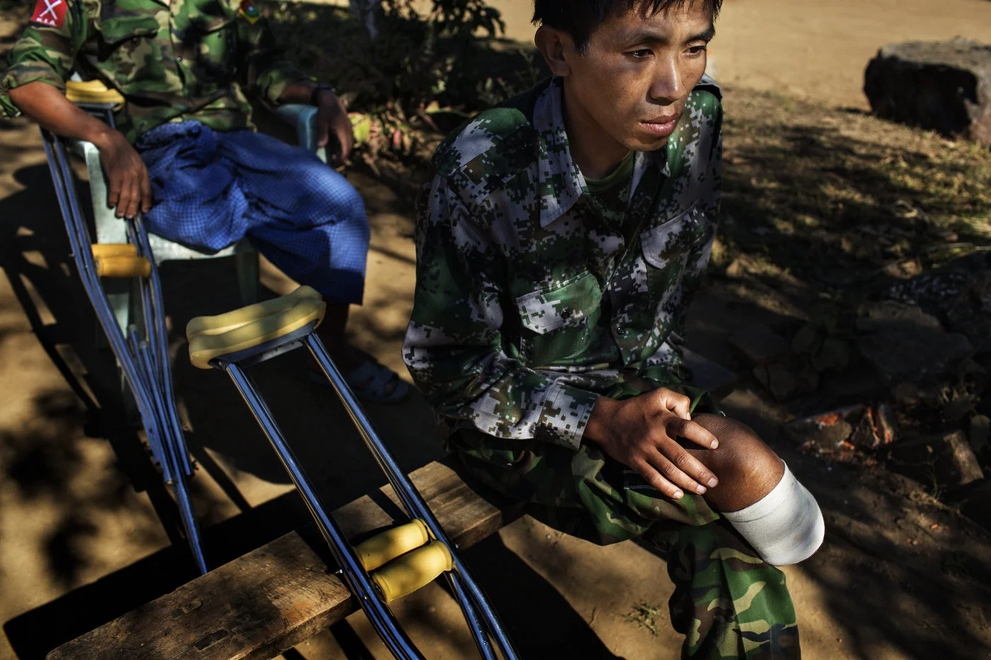 Two Kachin
Independence Army (KIA) soldiers who each lost a leg to Burmese Army land mines
rest in a hospital in Laiza, Kachin State in northern Myanmar.