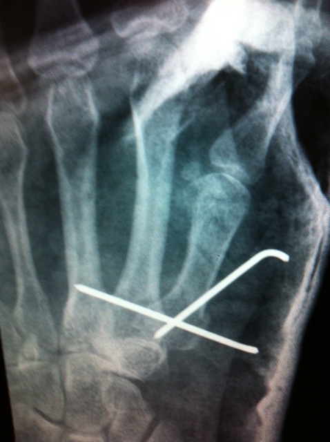 thumb.jpg