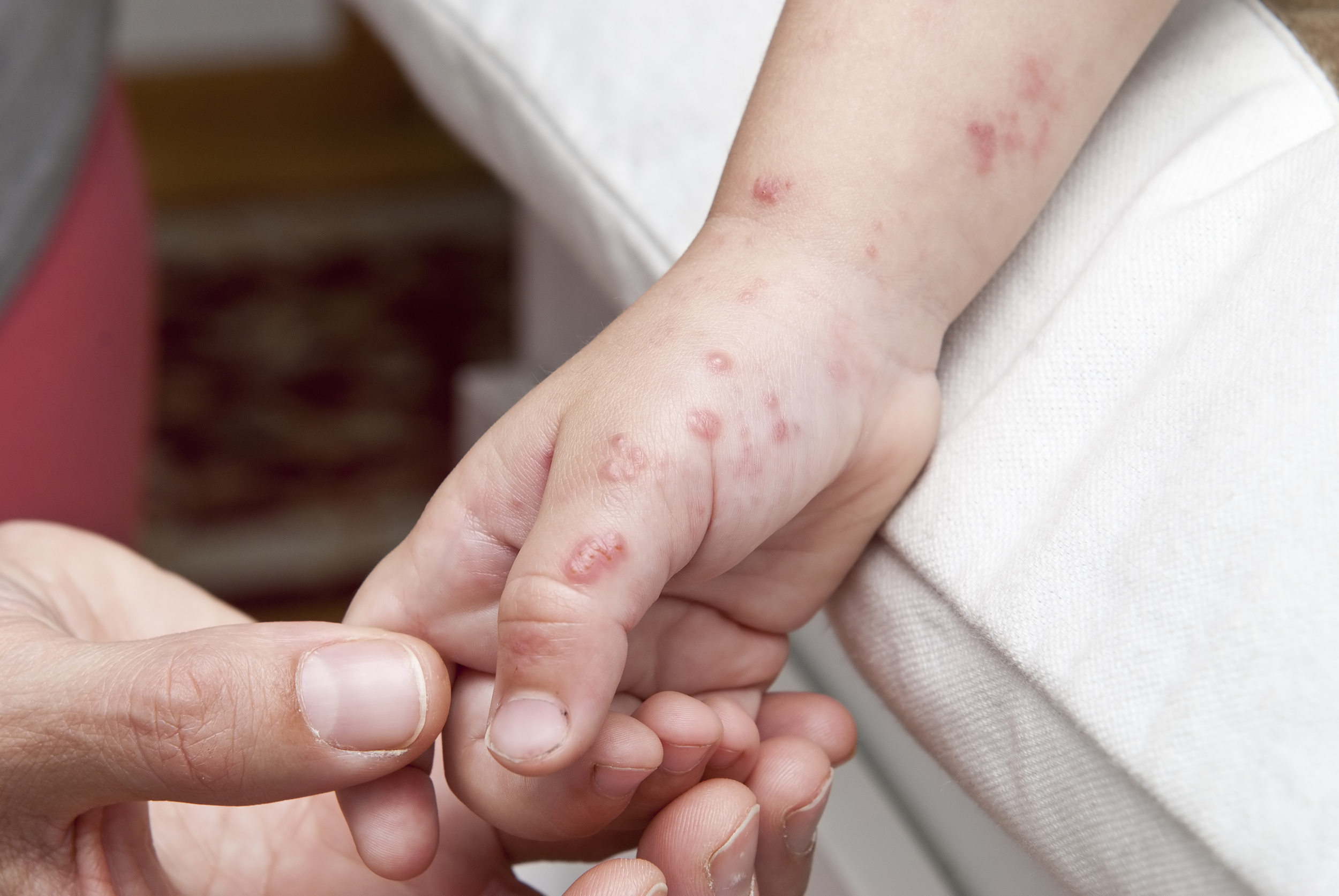 Evidence to suggests that anti-vaxx is far from doing good, the anti-vaxx movement is actually causing harm.