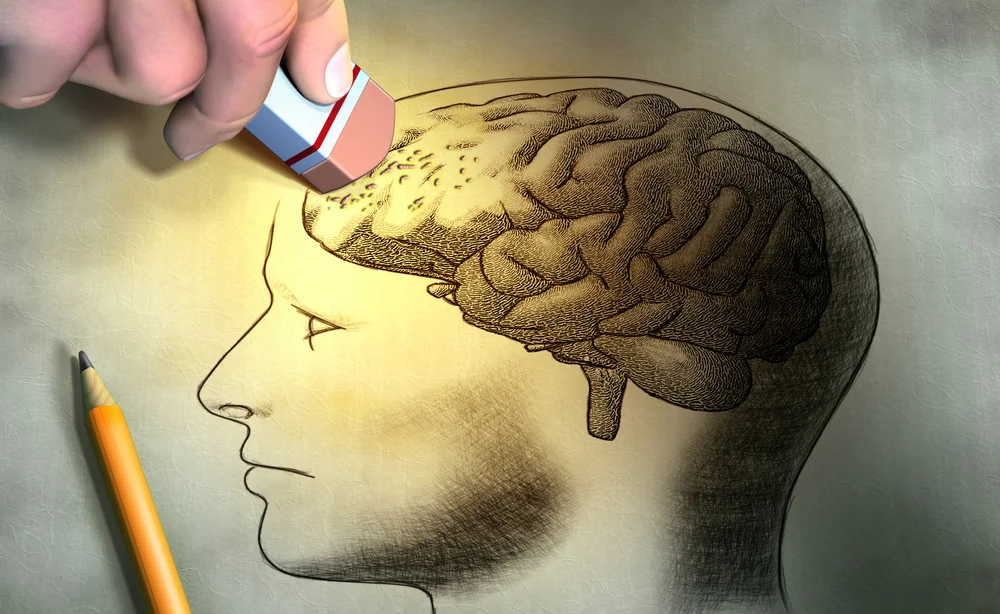 Morbo-di-Alzheimer.jpg