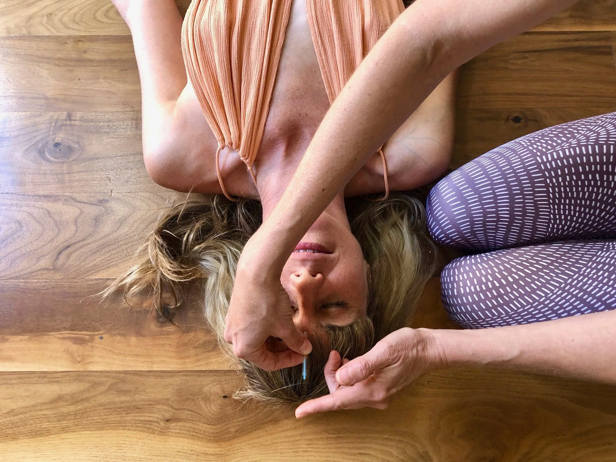 Community Acupuncture + Sound Healing