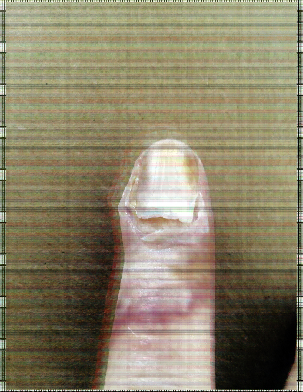 finger1.jpg