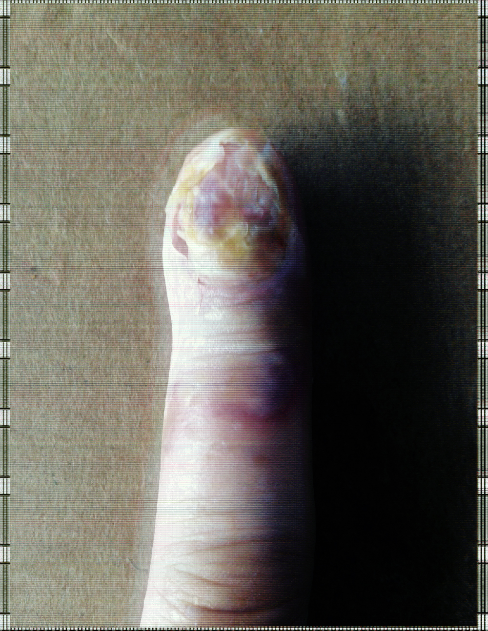 finger3.jpg