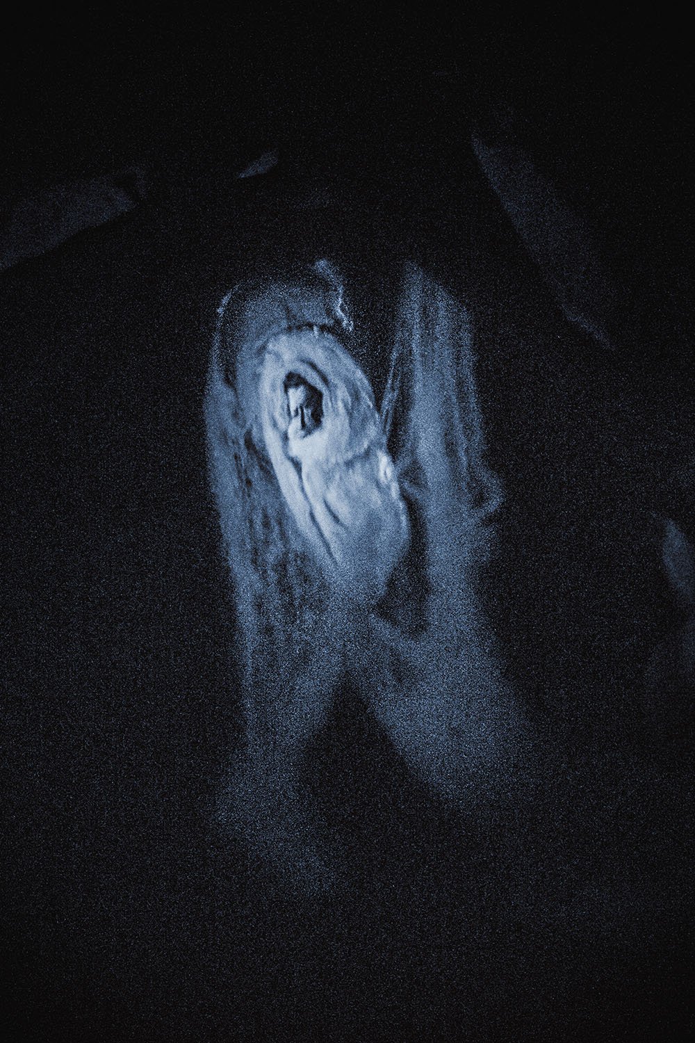 Medium Kai Muegge with ectoplasmic materialization of a man’s head, 2013. 