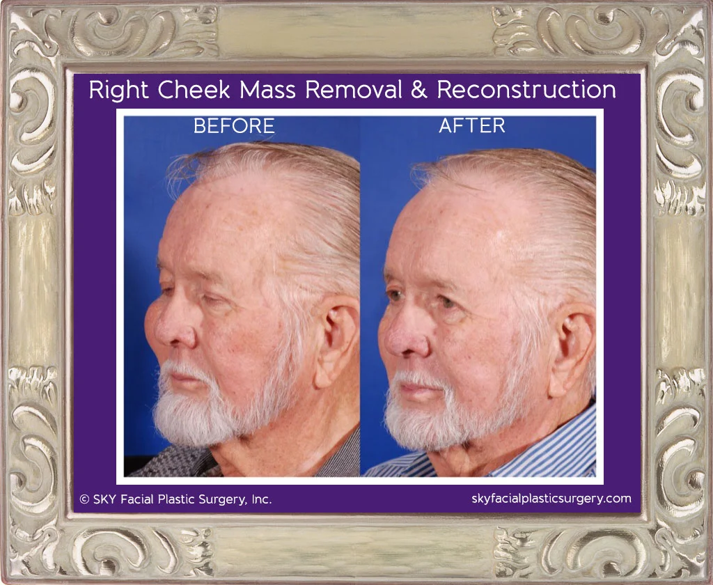 SKY-Reconstructive-Surgery-1B.jpg
