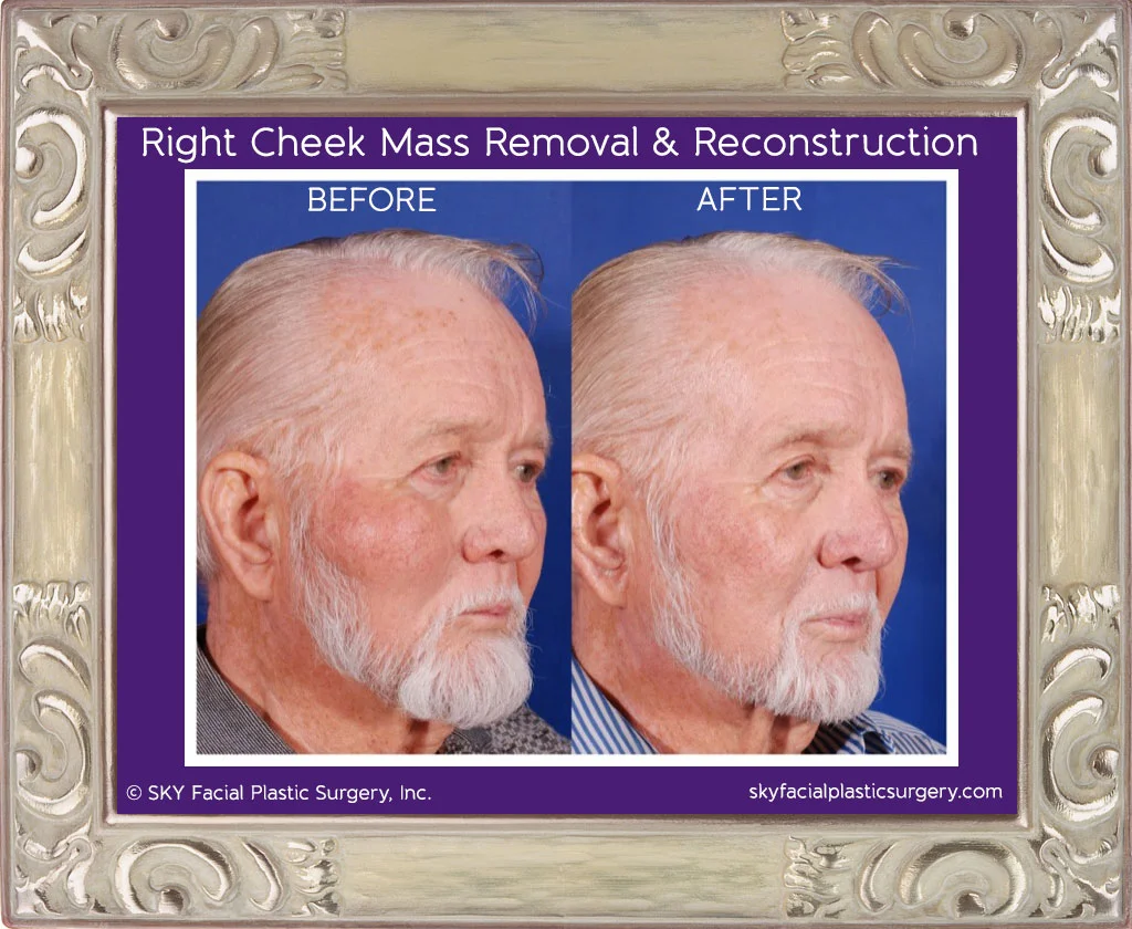 SKY-Reconstructive-Surgery-1D.jpg