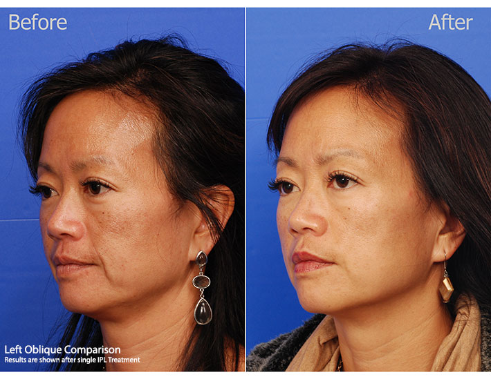 Left-TQ-Comparison2.jpg