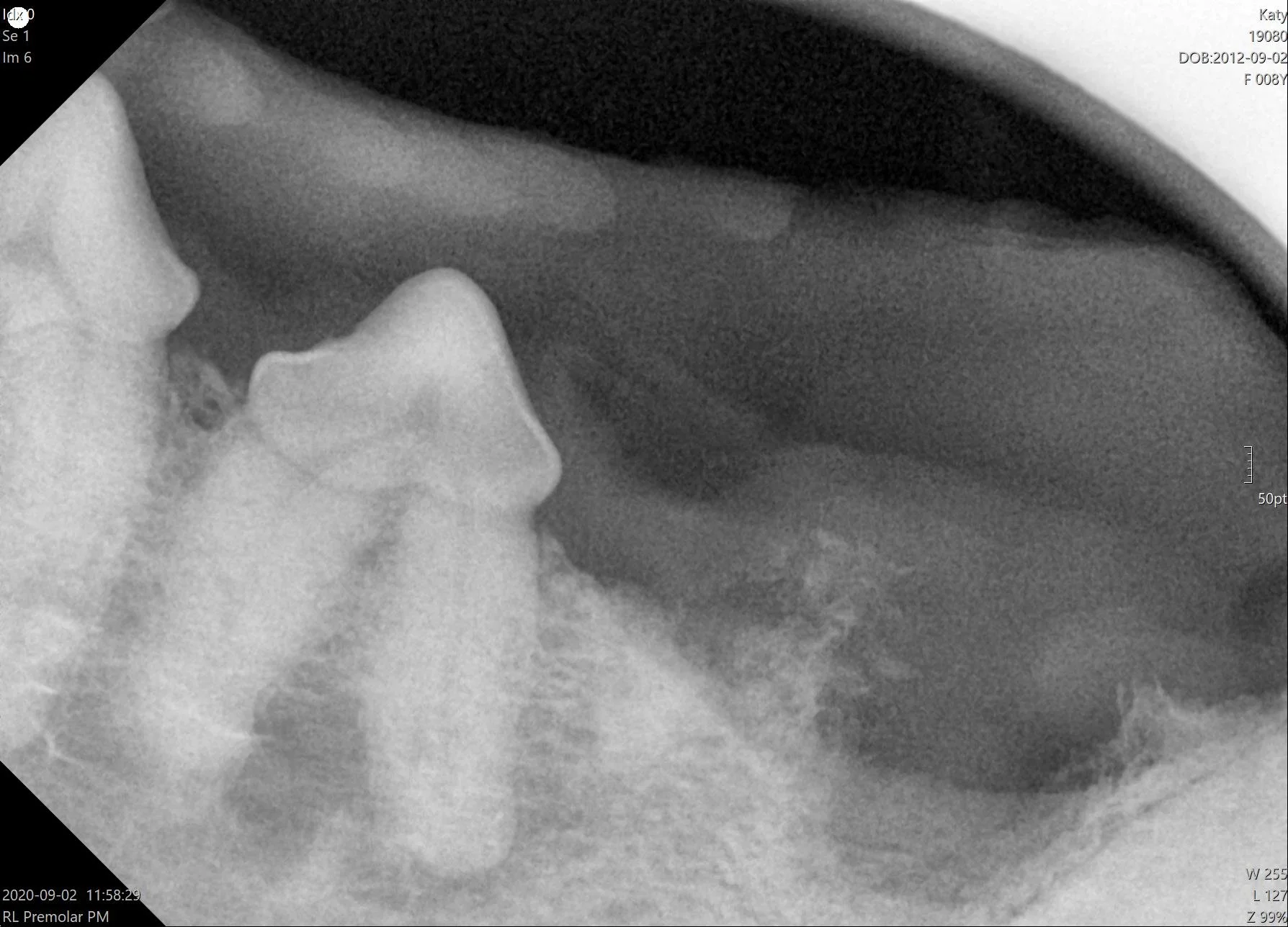 SOLD 5900 SOLD 2018 Dental Xray ImageVet™ FleXX Portable Intraoral