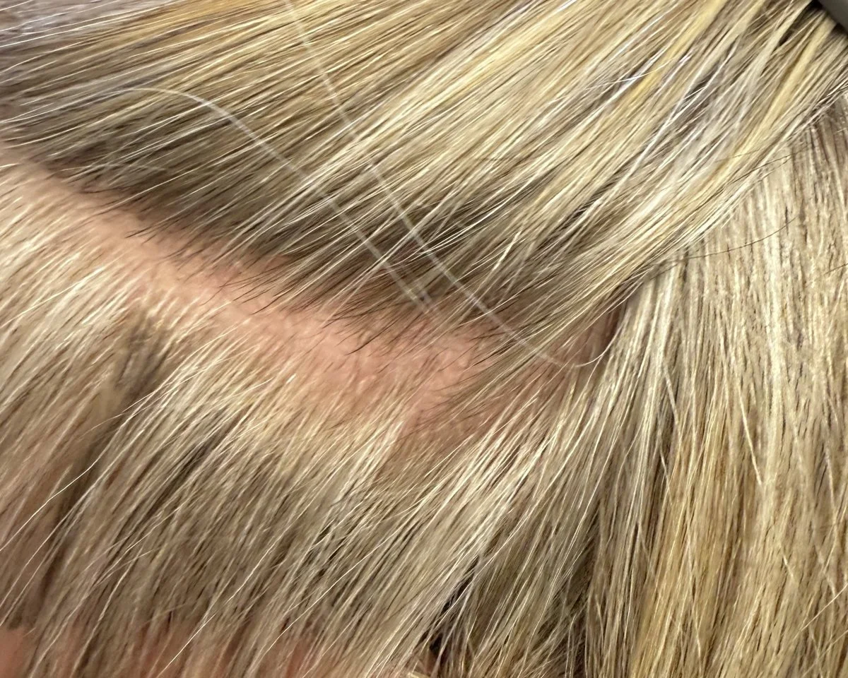 Client's thinning part blended with V-light hair extensions at Fusion Studio in Boise