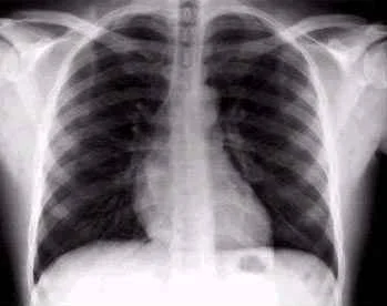 X-Ray Vision
