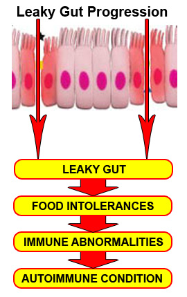 leaky_gut_progression.jpeg