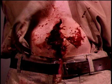 Huh. Pop Rocks and Coke really IS dangerous.