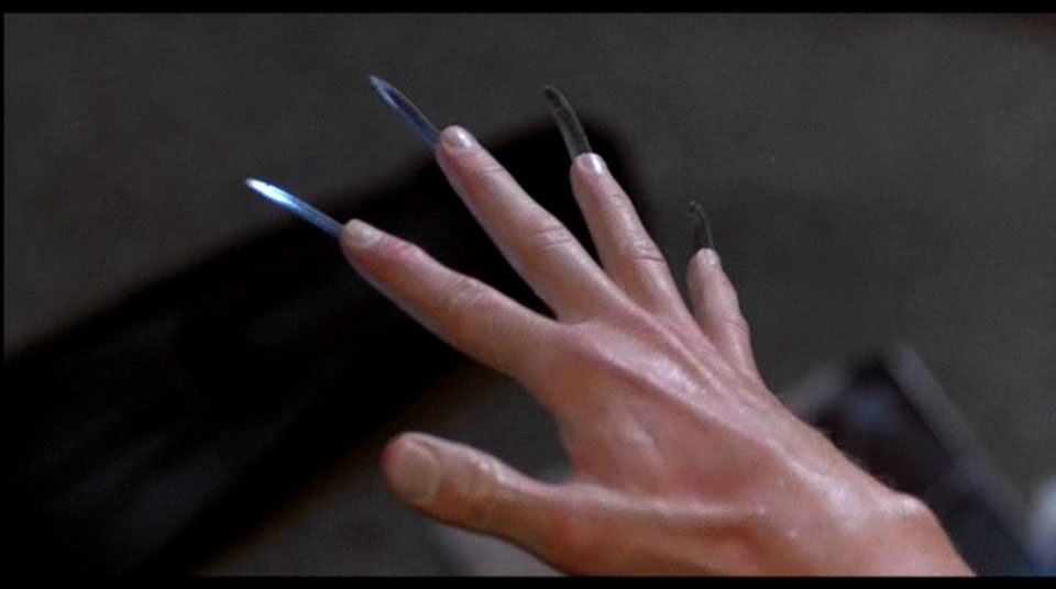 Whoa, someone needs a manicure.