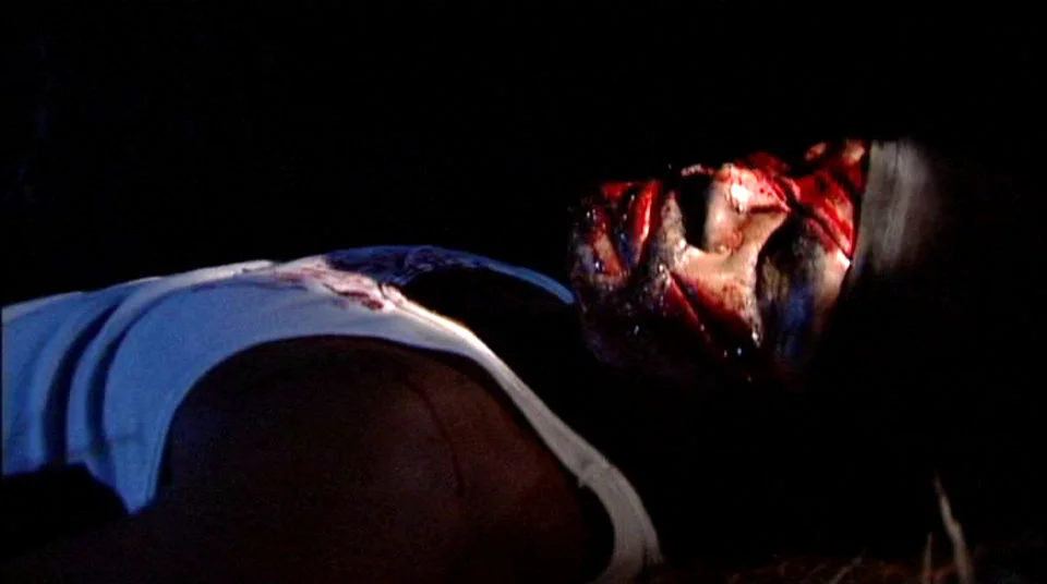 Did I ever tell you how I got these scars??