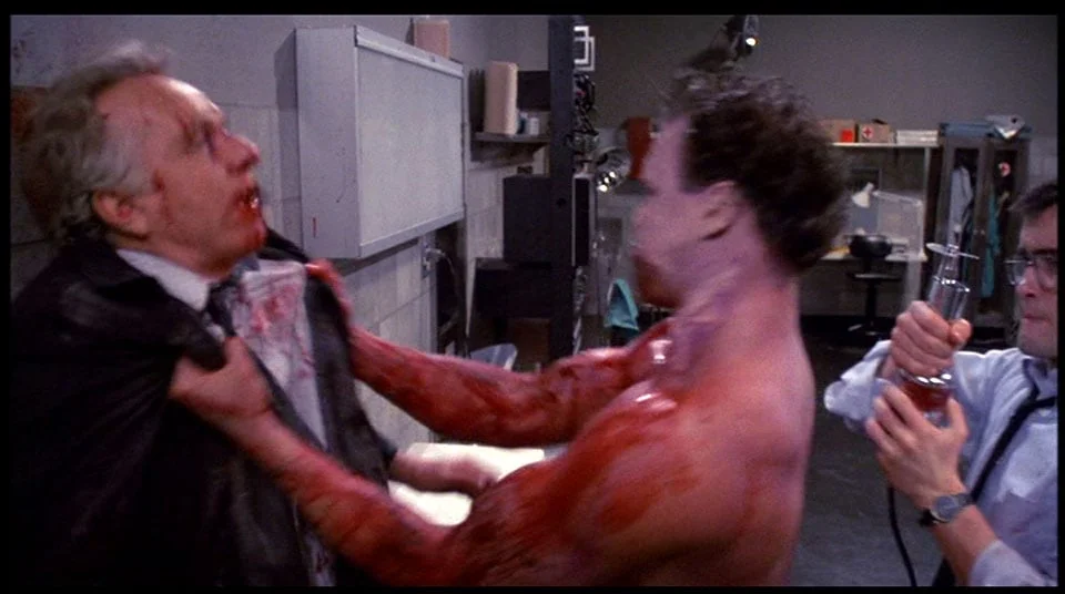 This is why steroids are bad.