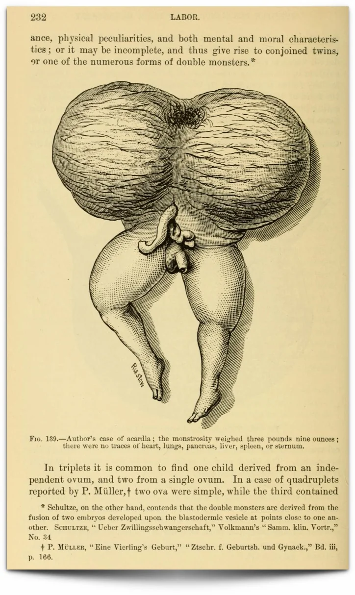 Z "The science and art of midwifery", William Thompson Lusk