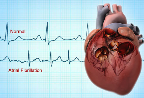AF heart.jpg