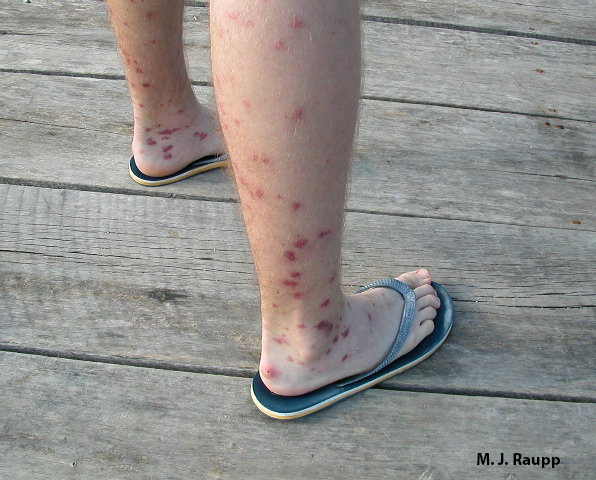 Amazing reddish welts and swollen legs were the handiwork of Belizean black flies suffered by many of the students and faculty who met these vicious vampires.