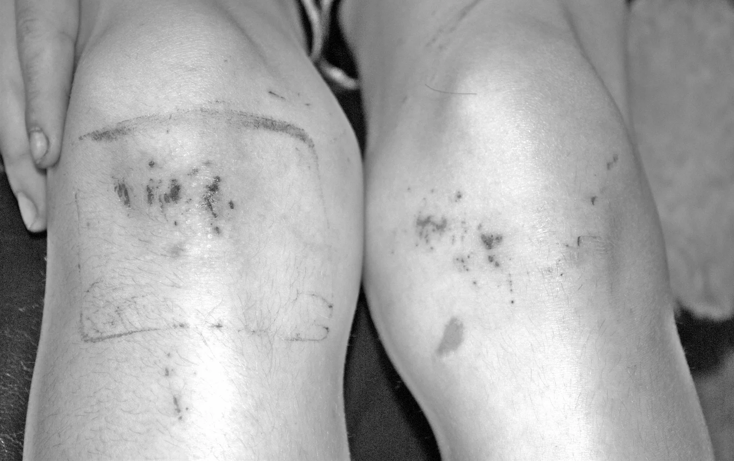 knees.jpeg