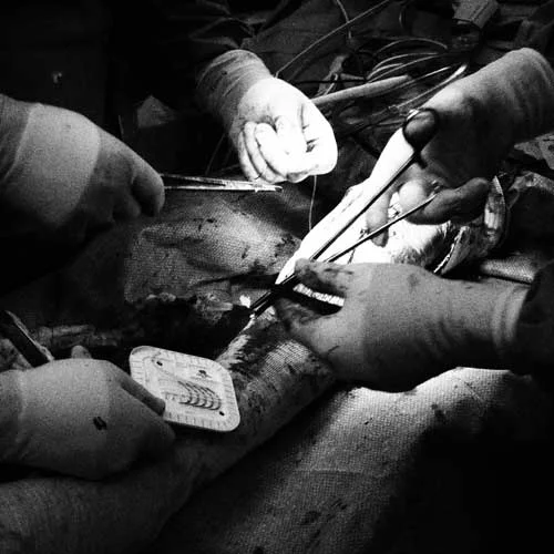 Surgery