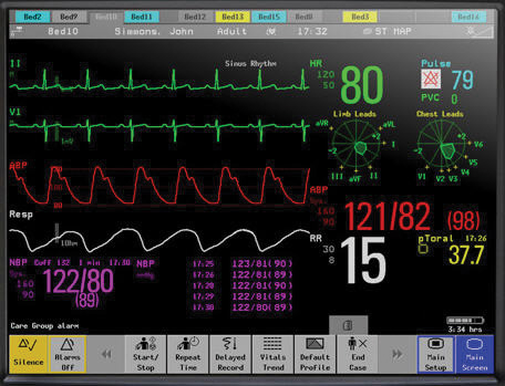 Patient Monitor.jpg