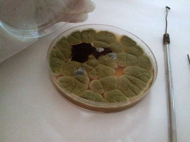 The wash basins near the guest room are always washed and sanitized with disinfectants & bleach; it even smells like a medical clinic.
This made them a candidate for my daughter's experiment:
Placed a petri dish near the wash basin for three hours.
Closed the dish and sealed it.
Placed in an incubator for one week.
Sectioned a part of it, stained, and examined under a microscope.
Due to time constrains, only the green part was examined, and it was a fungus named Aspergillus Flavus .
This has really gotten us thinking, what should one do to keep their homes clean?
Photo by: Fatma Alrefaa