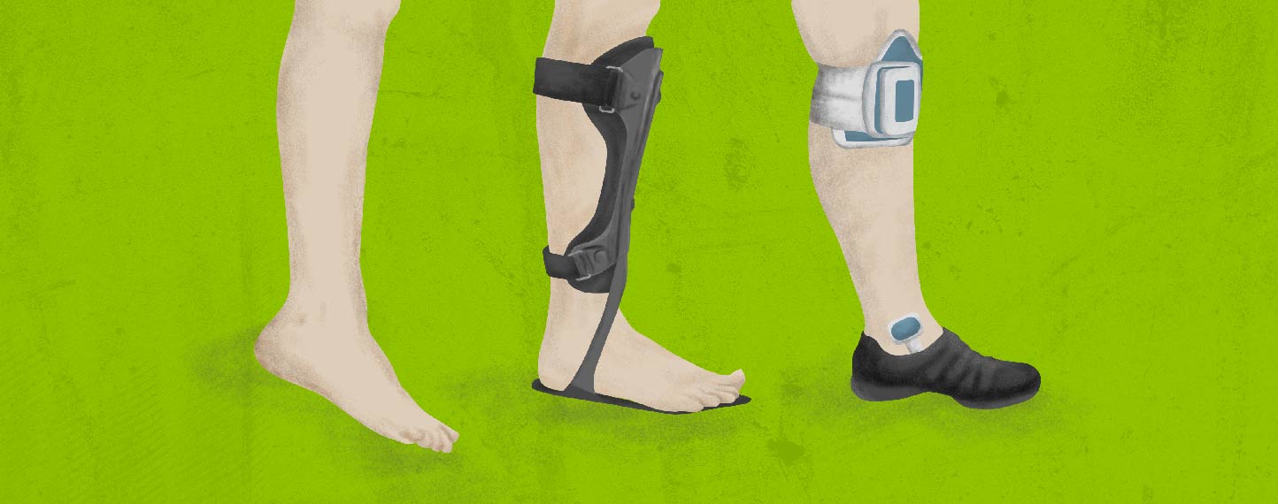 How to Keep Walking With MS-Related Foot Drop-01.jpg