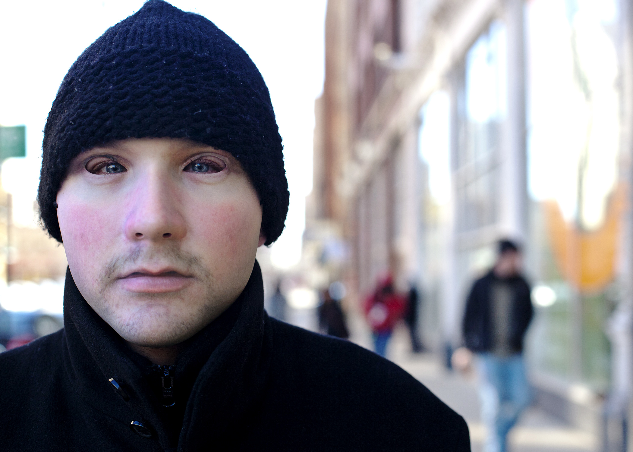 Prosthetic as worn by a pedestrian