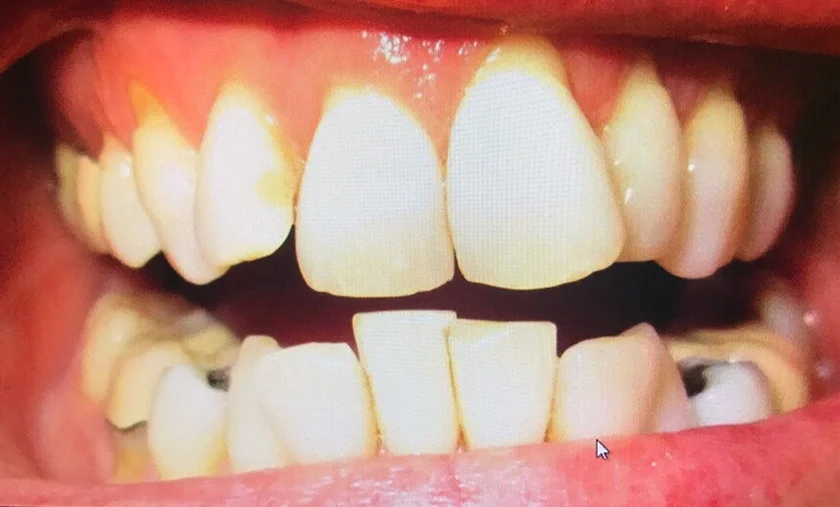 Witness some of Britain's finest dentistry! I know, they really were this shocking