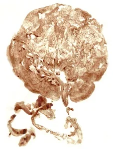 placenta-1.jpg