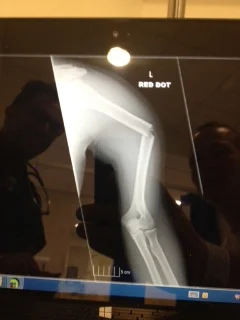 Been out of the game (A bit of a break)