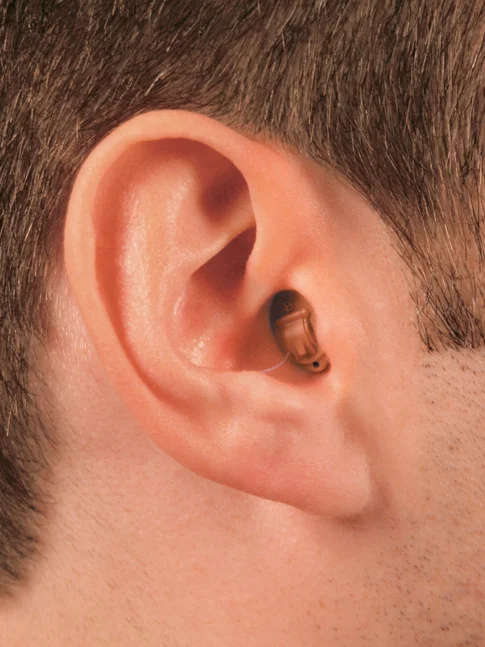 CIC in the ear