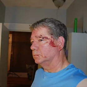 Harrisburg Weatherman Attacked and Beaten