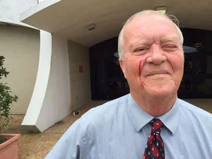 Commissioner Draws Blood After Hitting TV Reporter