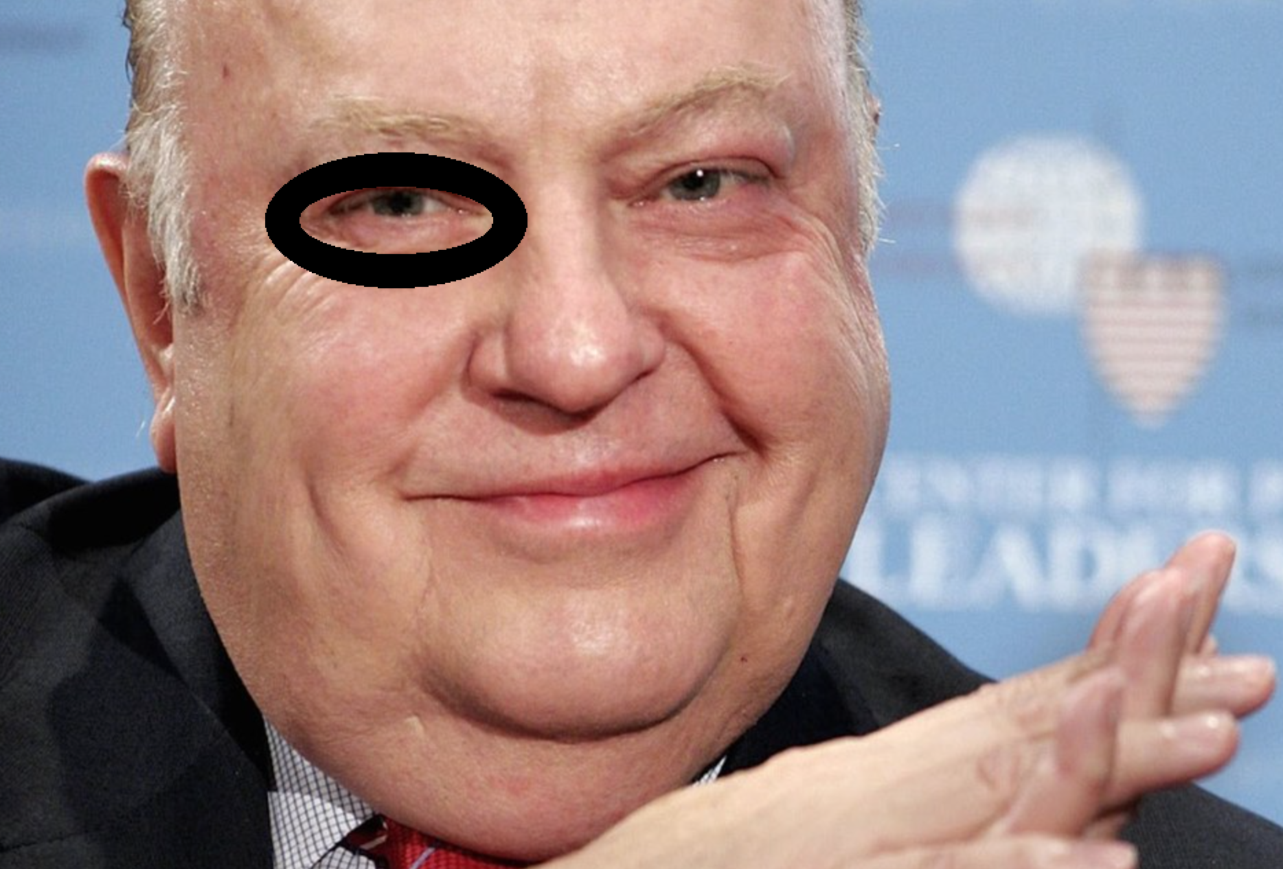 Who Gave Roger Ailes a Black Eye? 