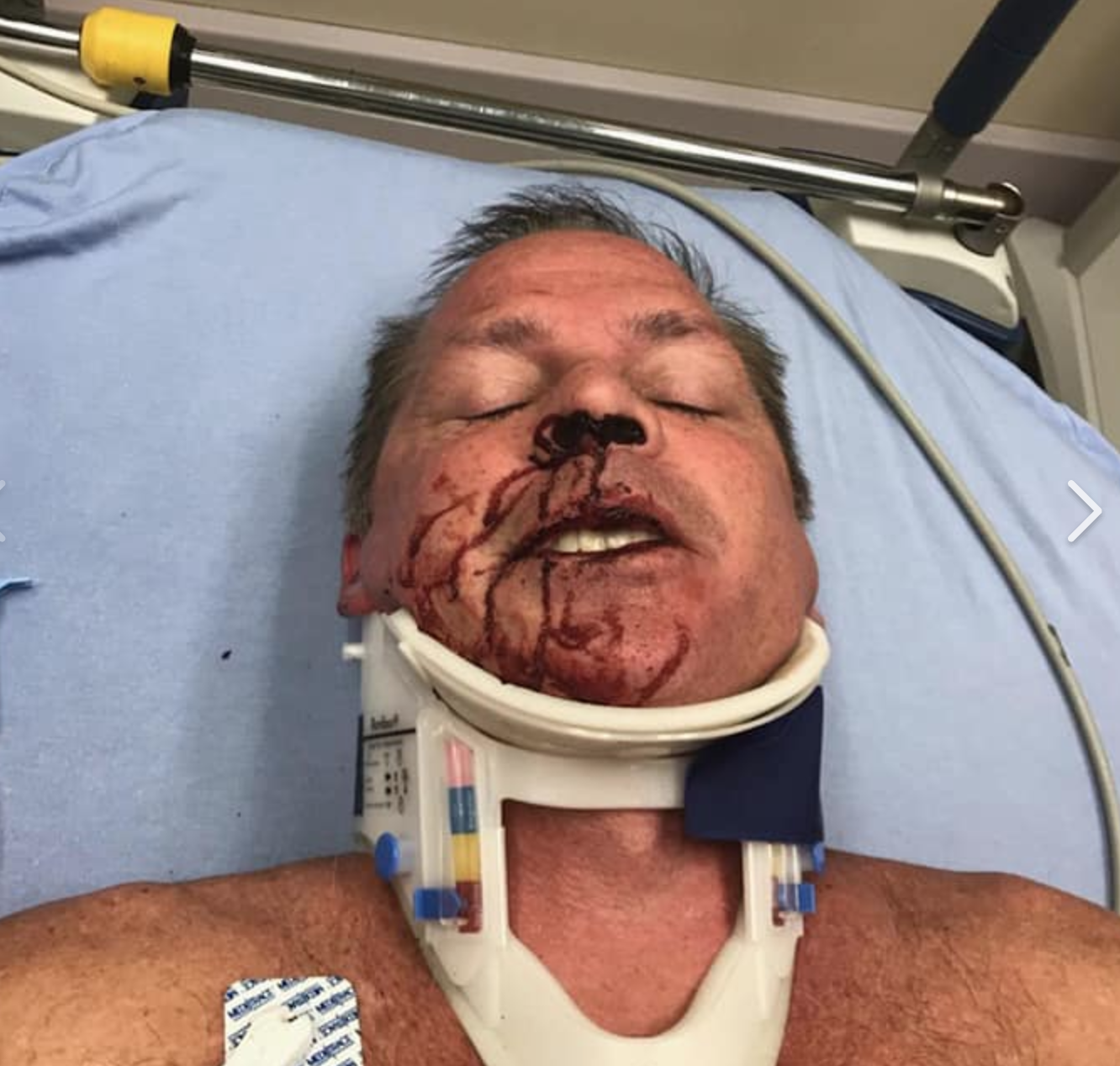 Albany Weatherman Hurt in Crash 