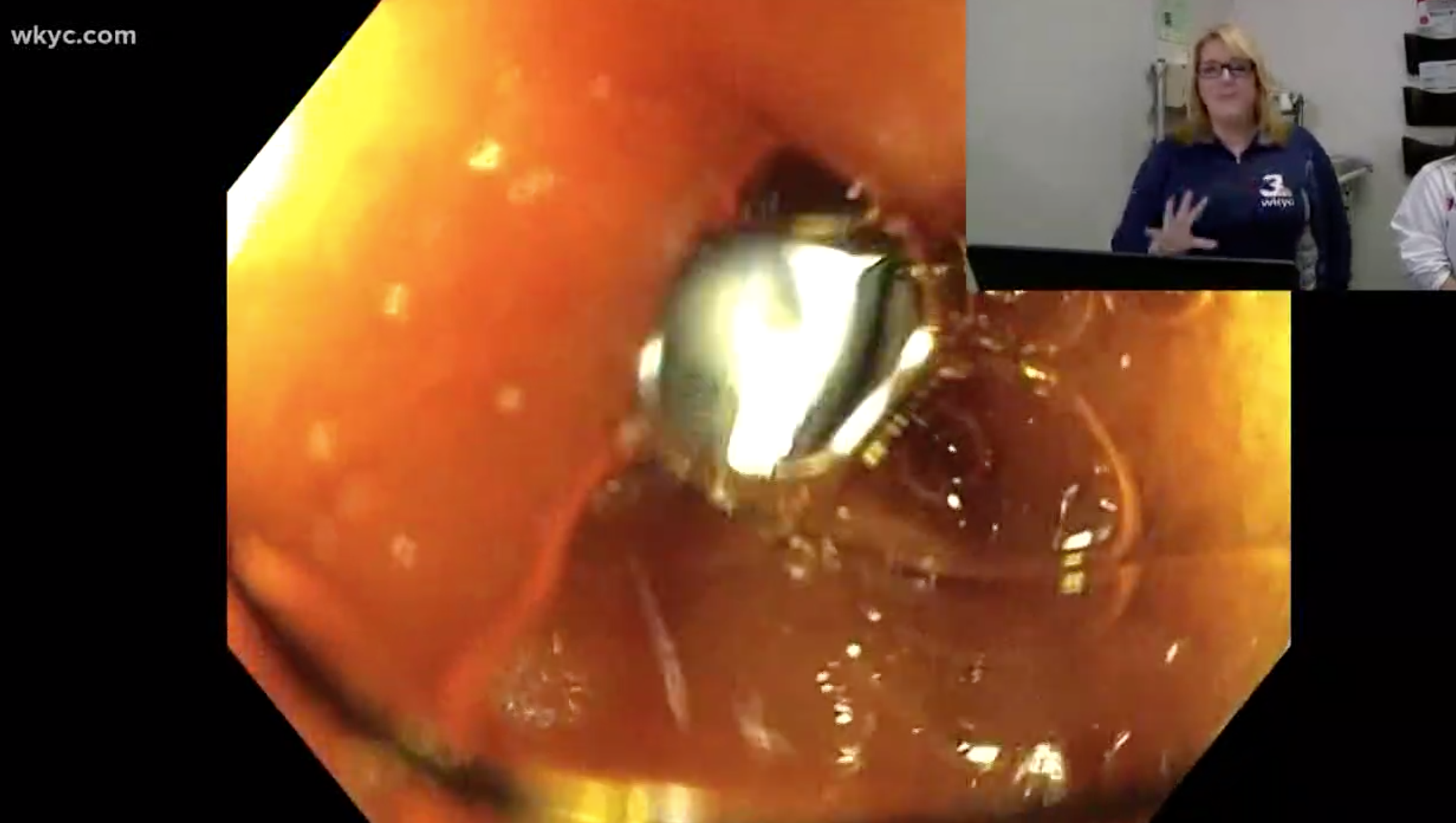 Live From Someone's Asshole 