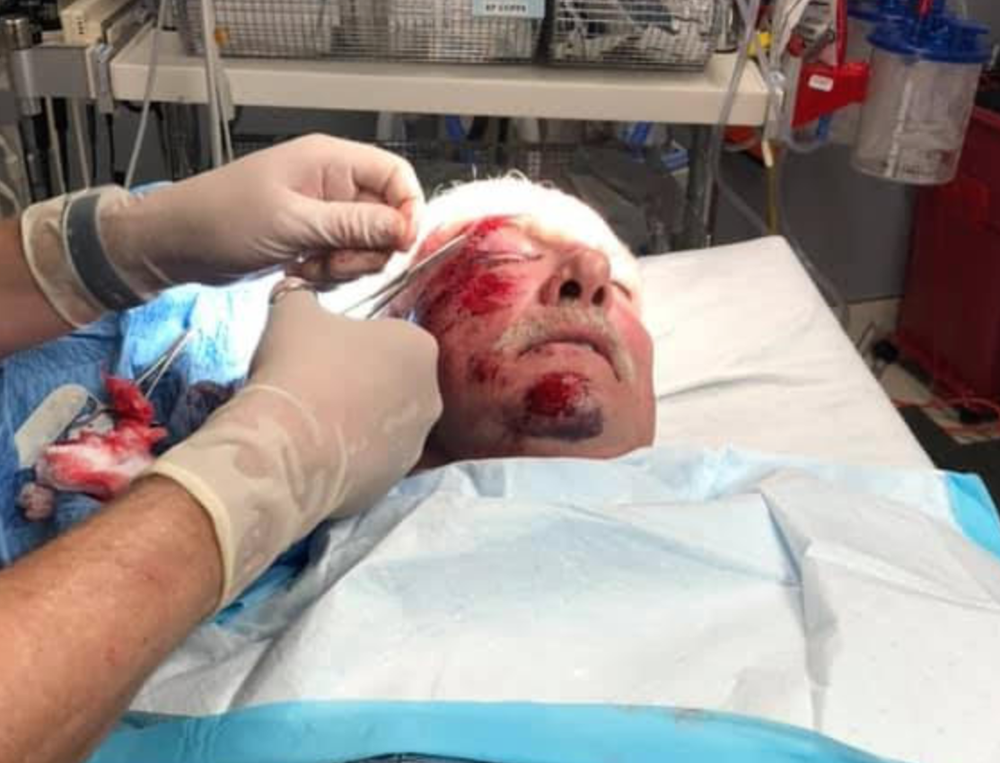 Boston Anchor Hurt in Bike Accident 