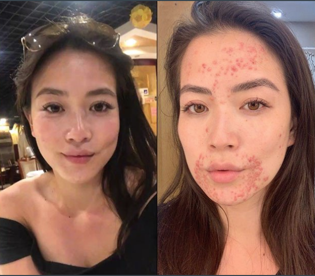 Miami Anchor To Take Time Off 