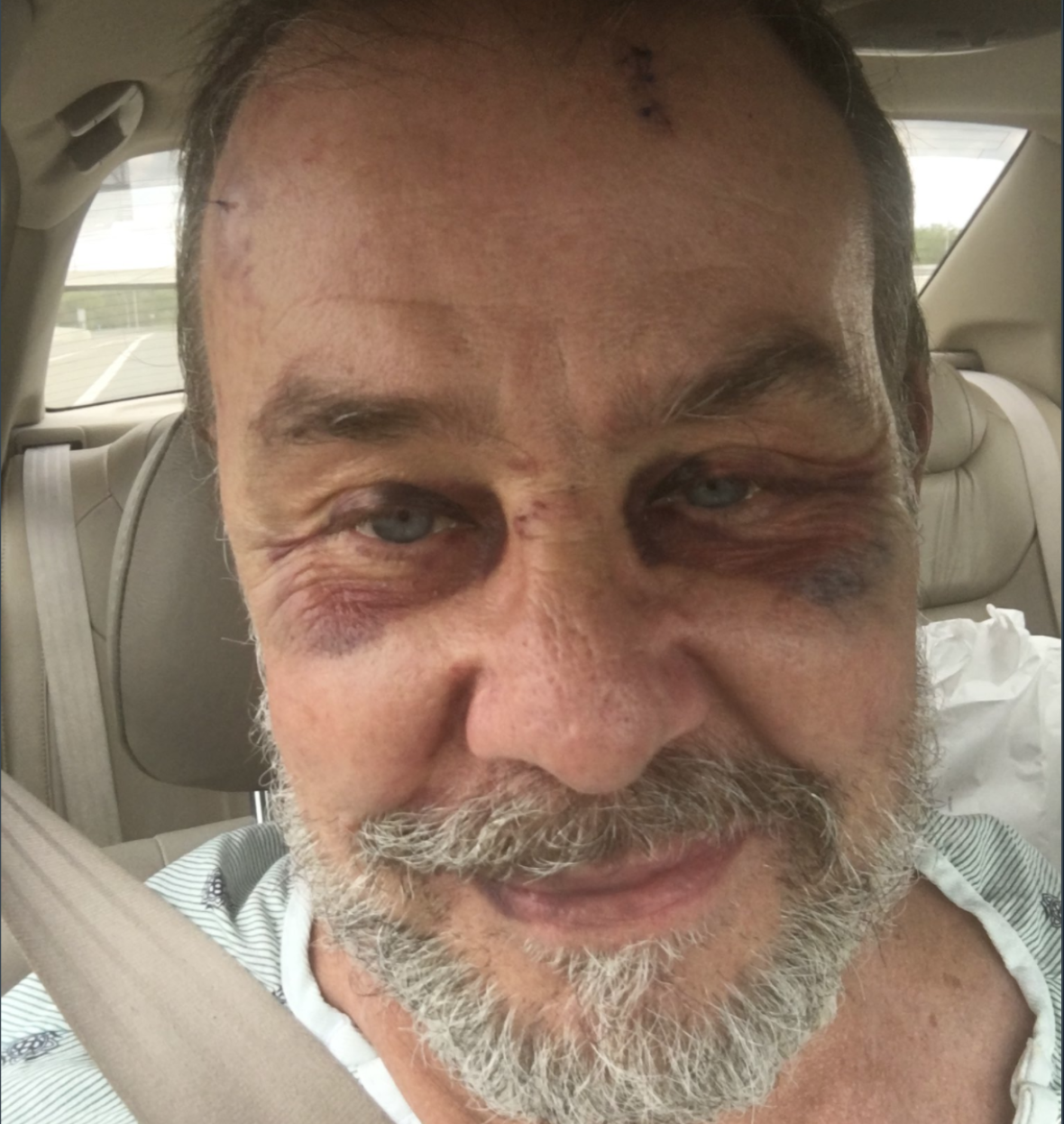 Photographer Attacked, Beaten and His Gear is Stolen 