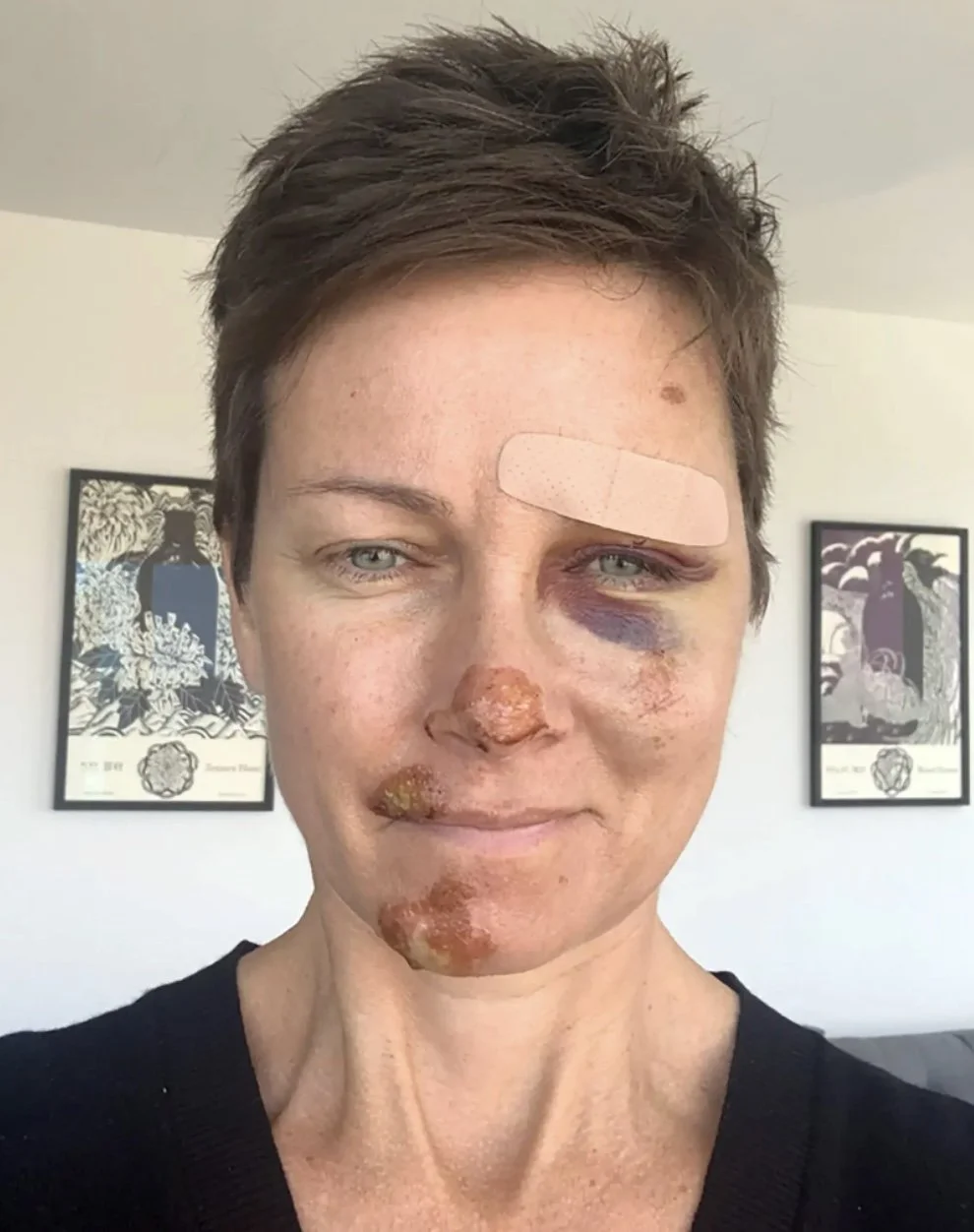 Ouch! 