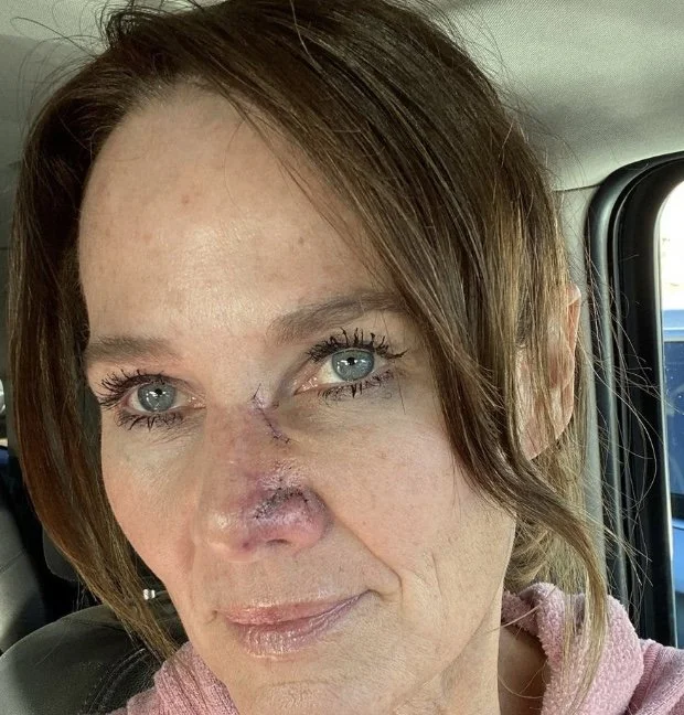 Under the Knife Again 