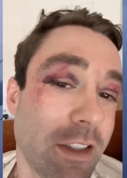 Fox News Met Beaten on Subway