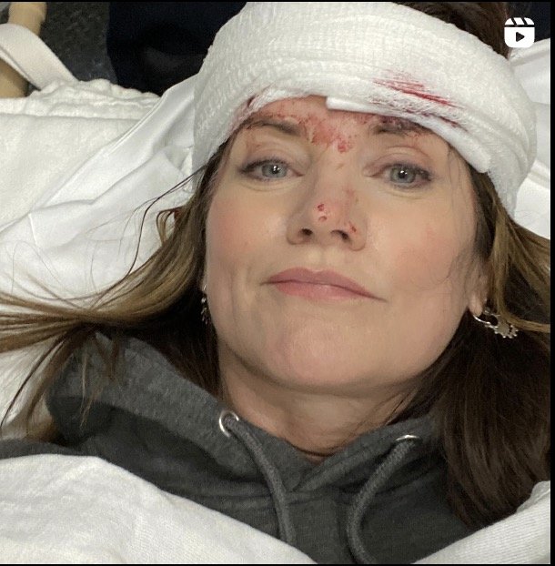 Ouch! 