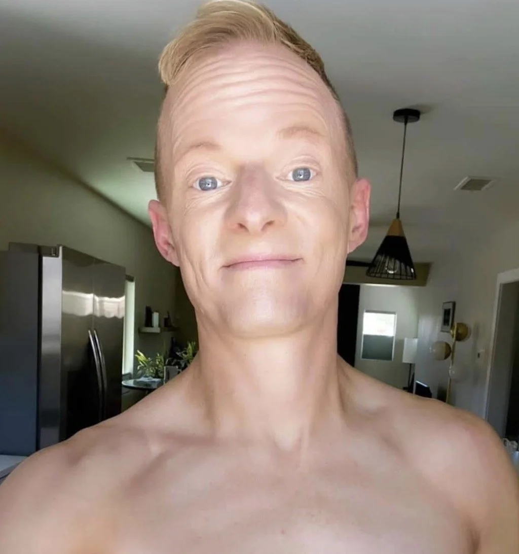 And, Here's the Flip Side... 