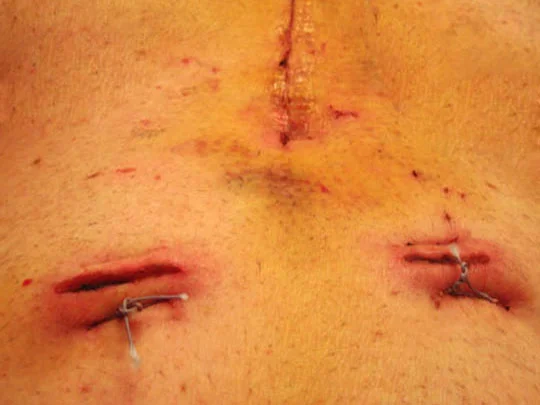 8. tubes_oct31-18.jpg