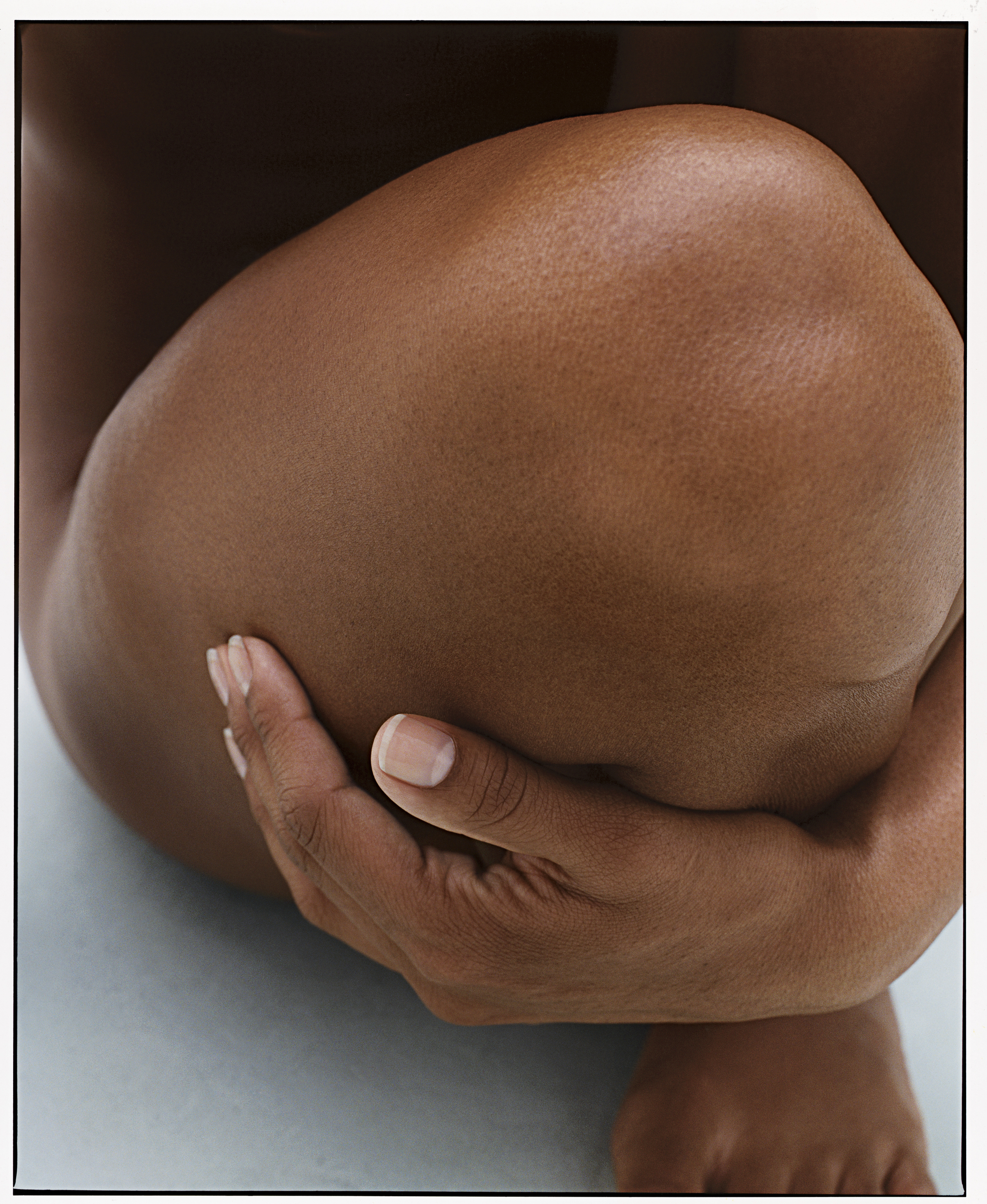 KNEE SCAN_after.jpg
