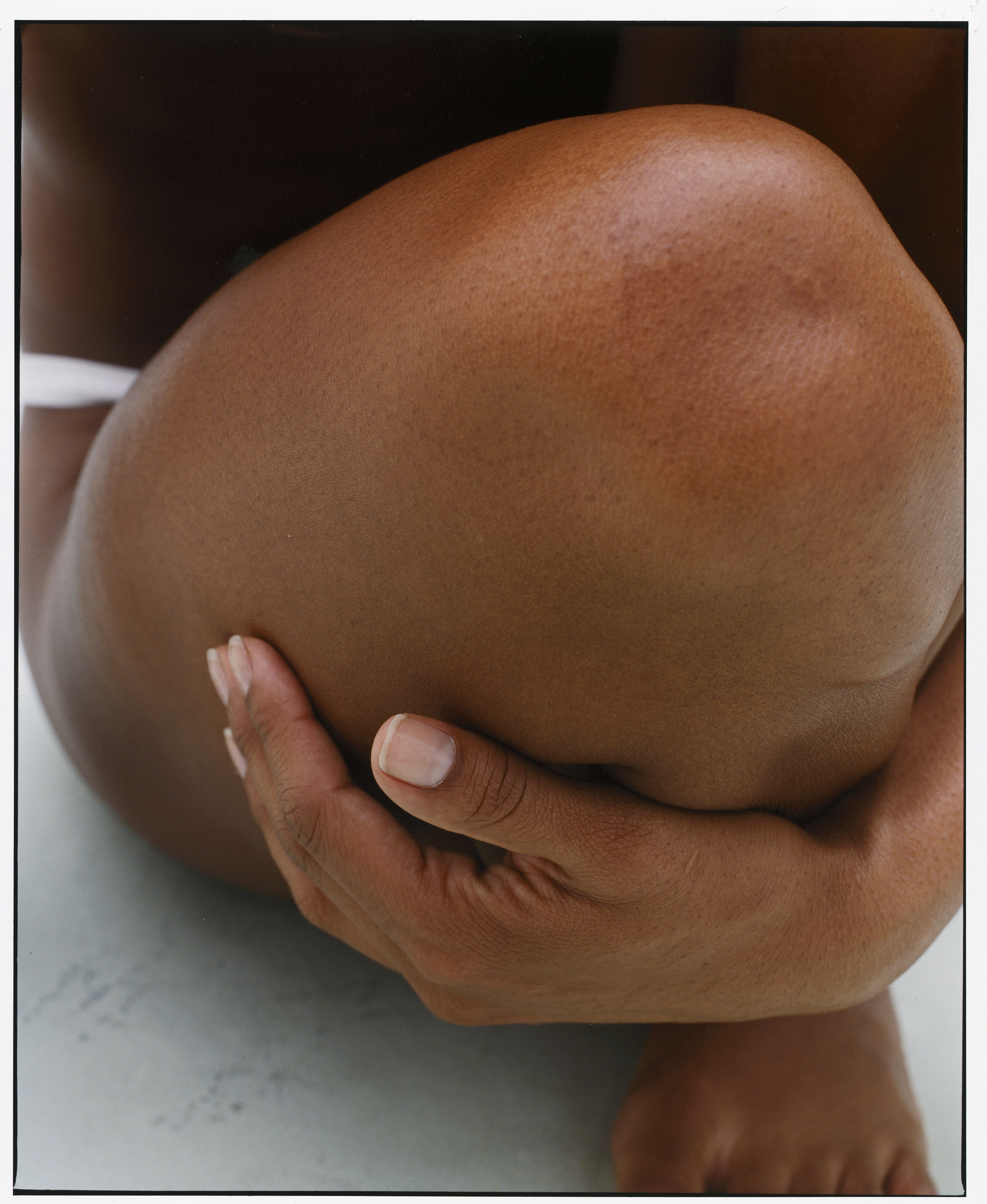 KNEE SCAN_before.jpg